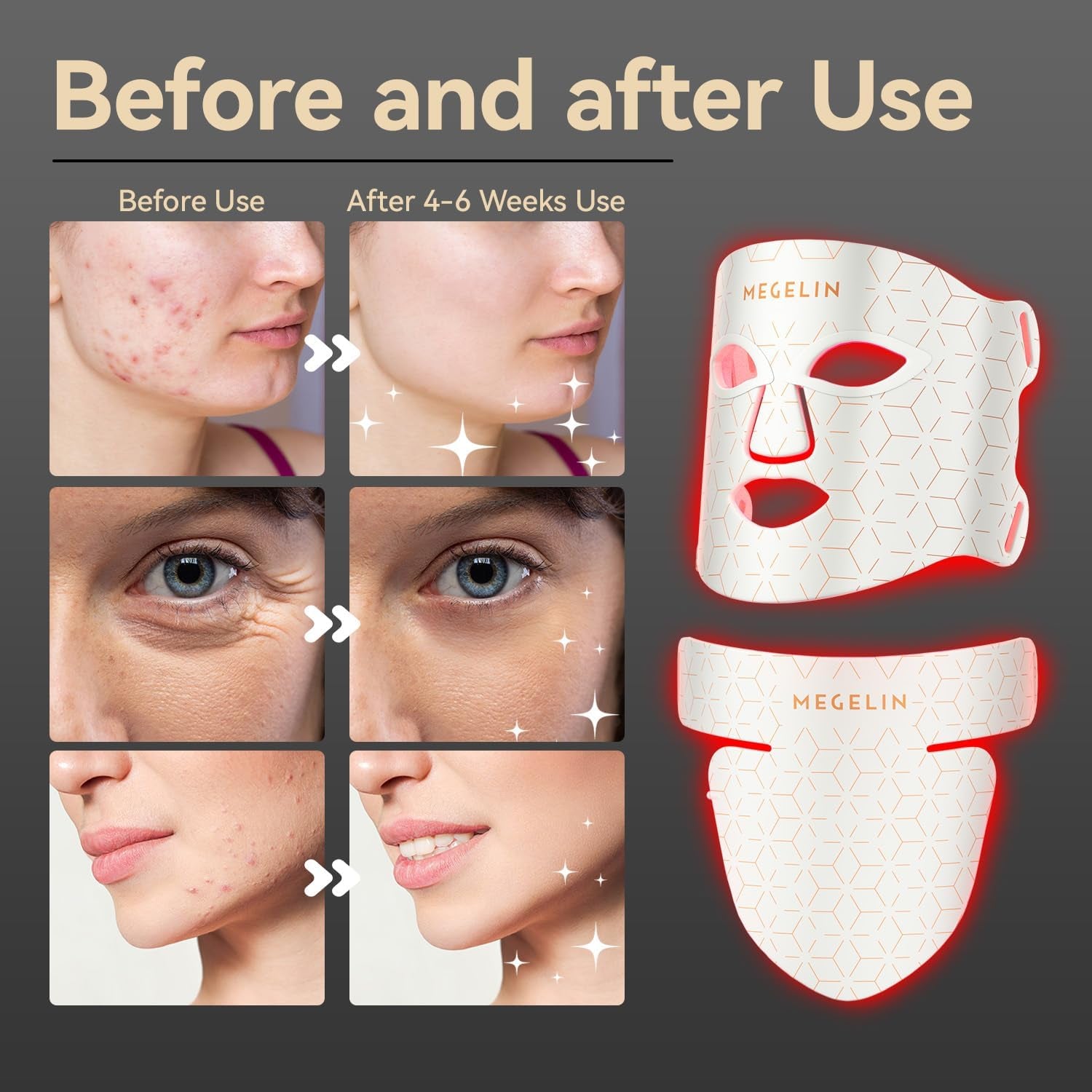 7 Colors Led Red Light Therapy Face & Neck Mask, Led Light Therapy Mask for Face