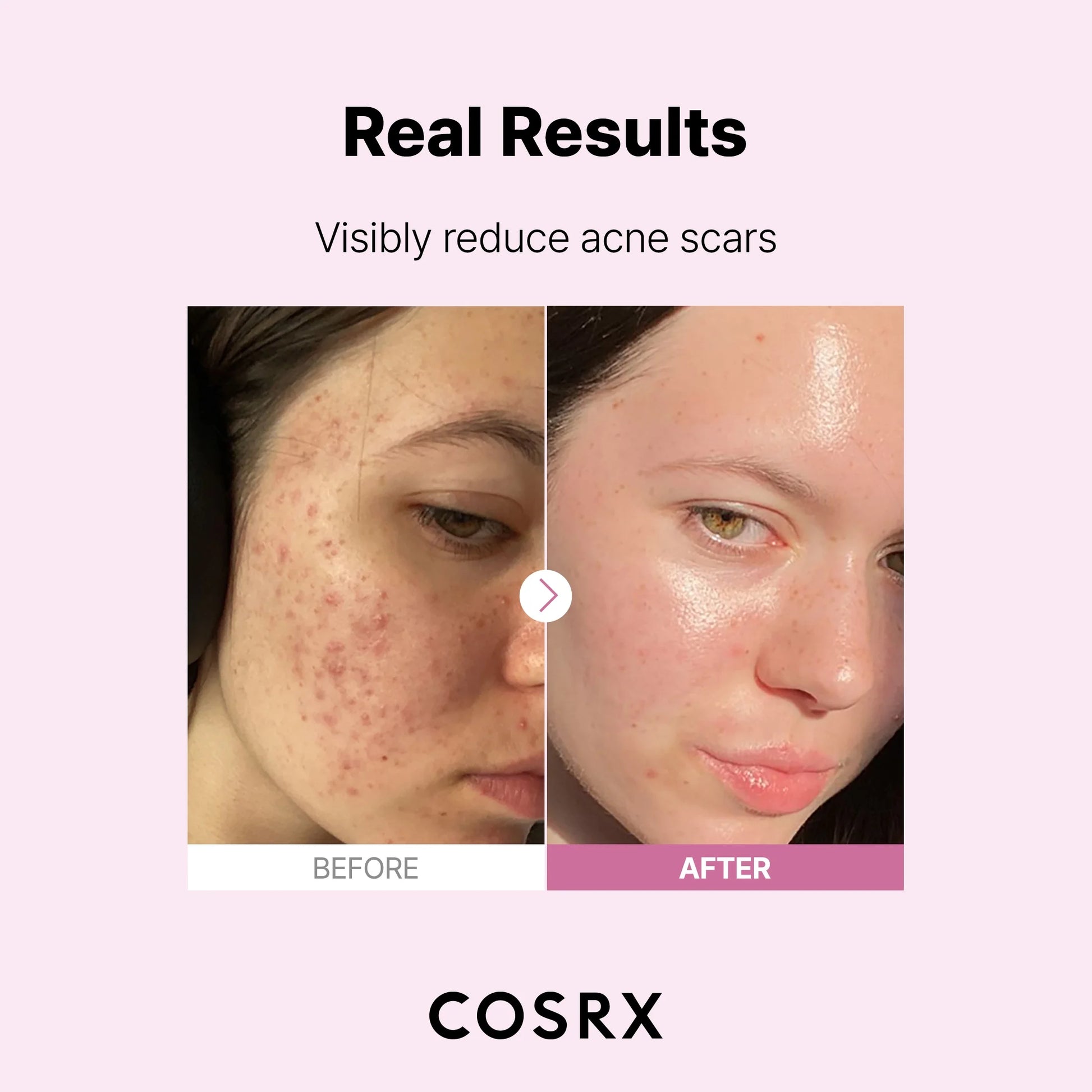 the Niacinamide 15 Serum (0.68 Fl.Oz)