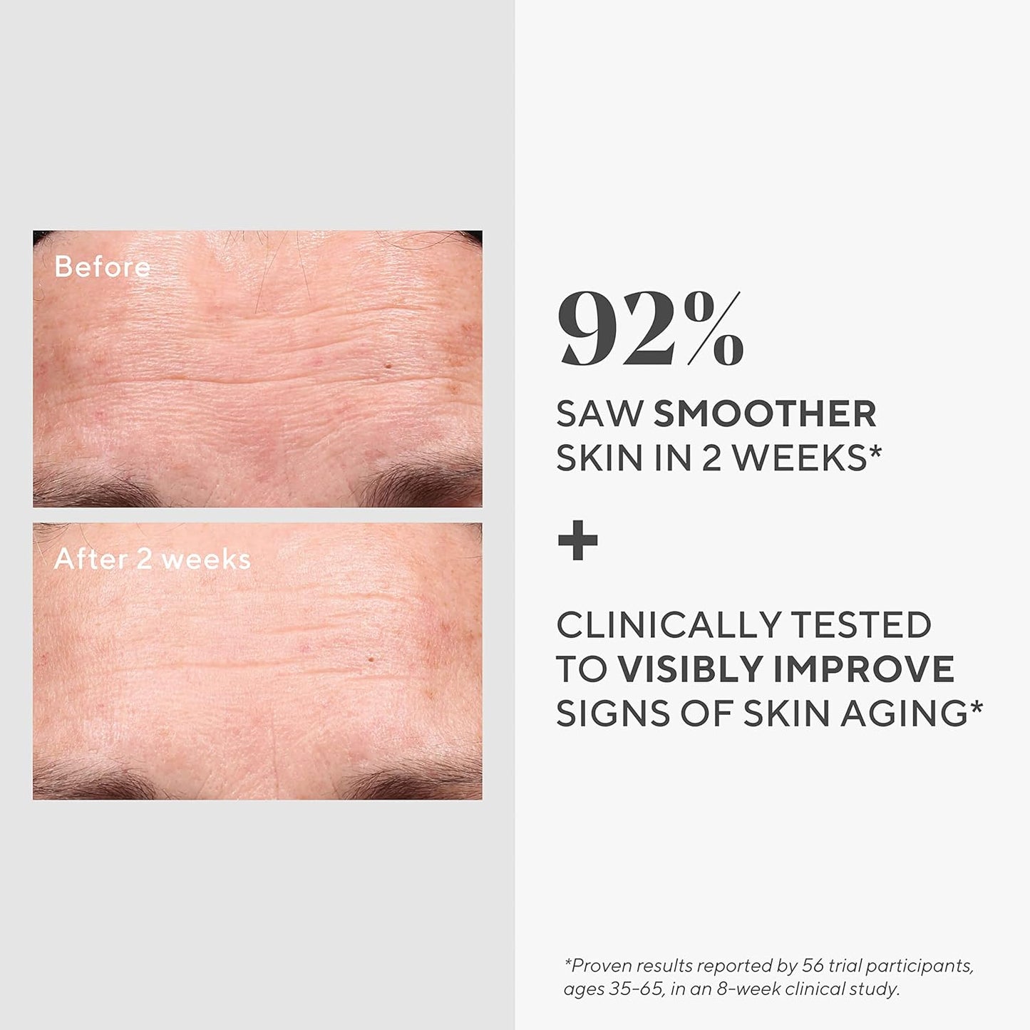 Retinol Youth Renewal Serum - Fast-Acting Retinol Treatment with Swertia & Hyaluronic Acid for Visible Anti-Aging Results - Tri-Active Technology Gently Reduces Wrinkles & Firms Skin