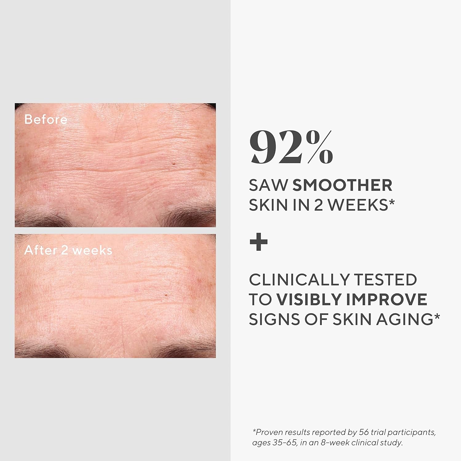 Retinol Youth Renewal Serum - Fast-Acting Retinol Treatment with Swertia & Hyaluronic Acid for Visible Anti-Aging Results - Tri-Active Technology Gently Reduces Wrinkles & Firms Skin